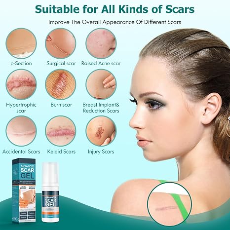 Advanced Scar Gel - Image 3